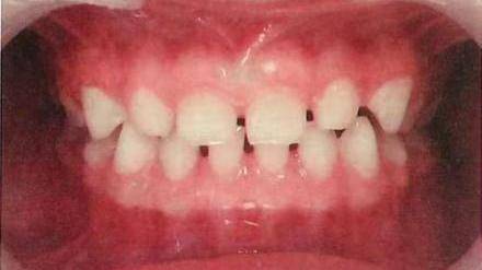 可能是身体这里,出了问题!_进行_牙齿