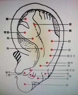 這項神奇的治療您知多少_耳穴_耳廓_耳朵