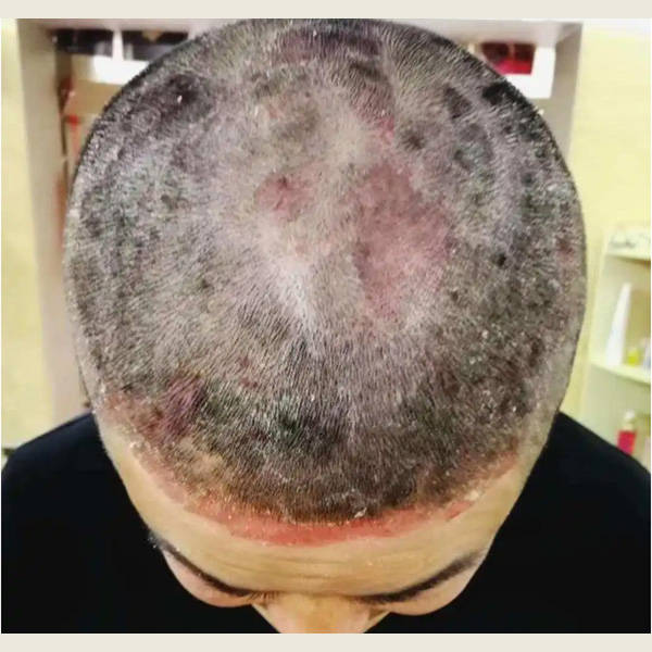 口碑最好的洗发水推荐_头皮_问题_皮肤