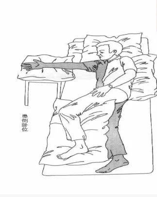 具体怎样摆放?_关节_患者_体位