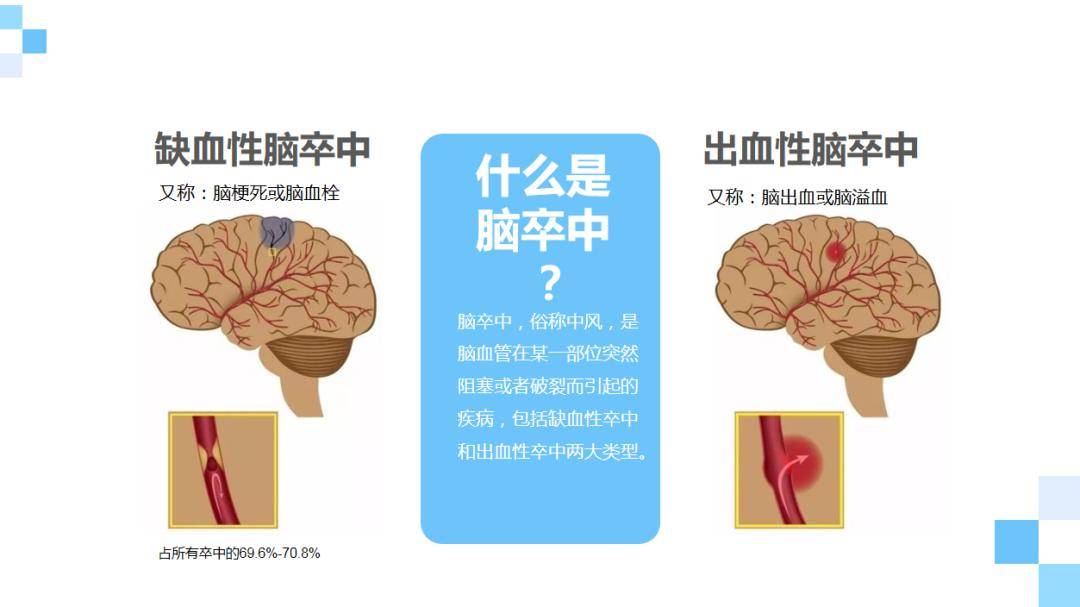 【青年骨干谈科普】王洋主任:认识脑卒中