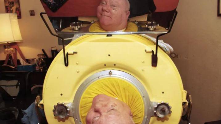 被困"铁皮棺材"69年,终生丧失自由,仅靠嘴生活…世界上最后的"铁肺"人