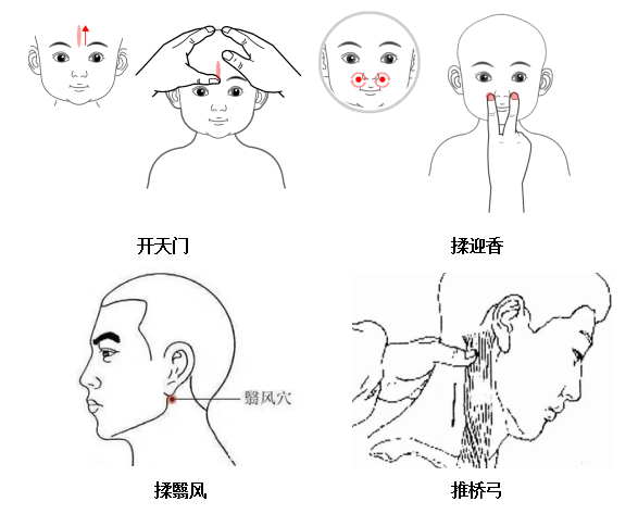 小儿腺样体肥大不仅影响发育,还影响智商和颜值,这几招可防_儿童_推拿