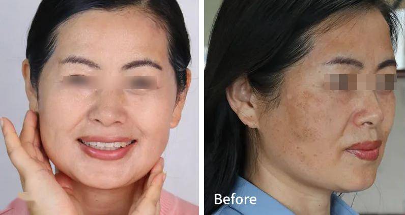 脸上有斑,暗黄的人要常喝,气血通畅少生病!_红玫瑰_原料_问题