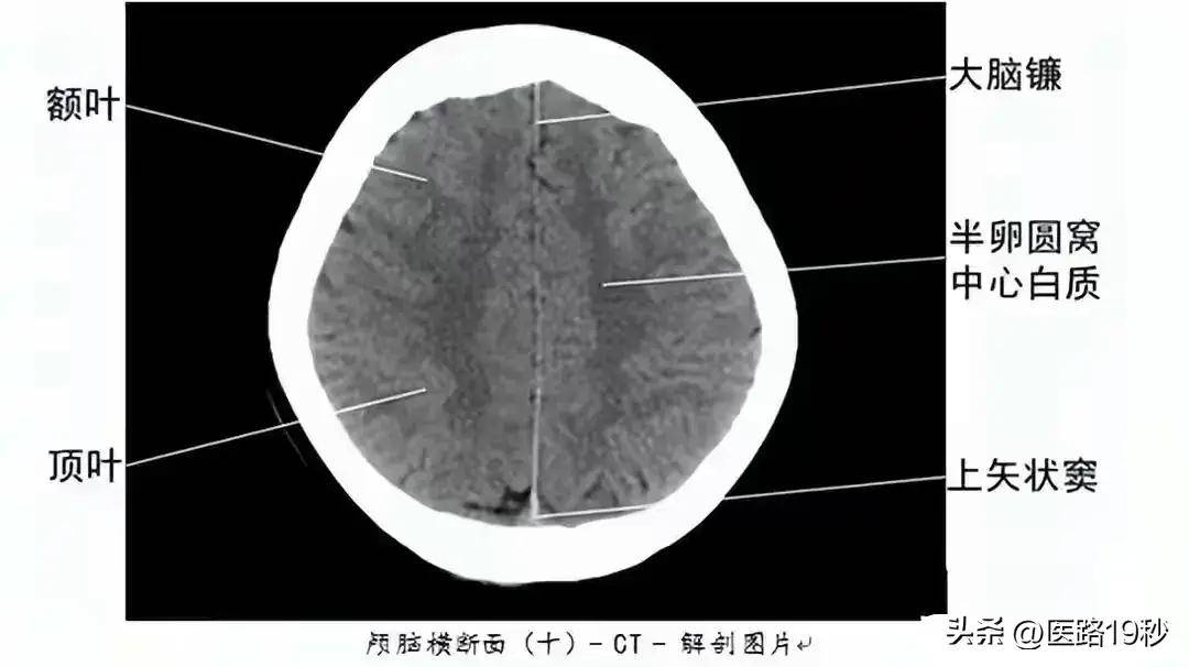 影像科医生整理的影响检查解剖图