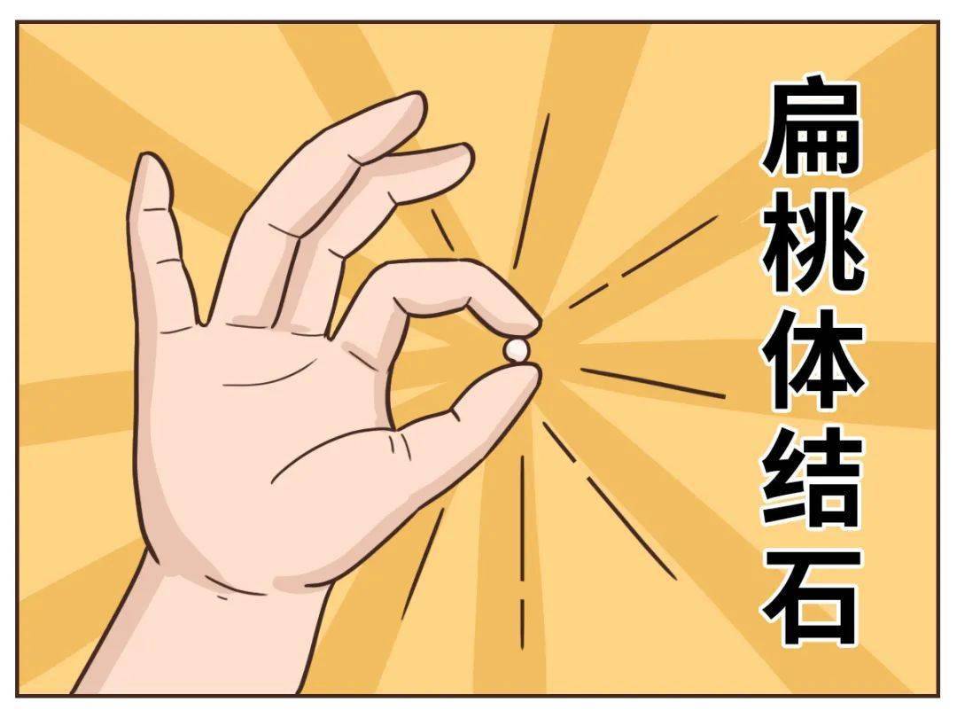过这样的经历或许它还可以让你口臭答案是——扁桃体除了发炎还能干嘛