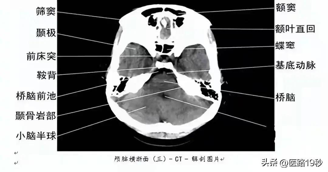 影像科医生整理的影响检查解剖图