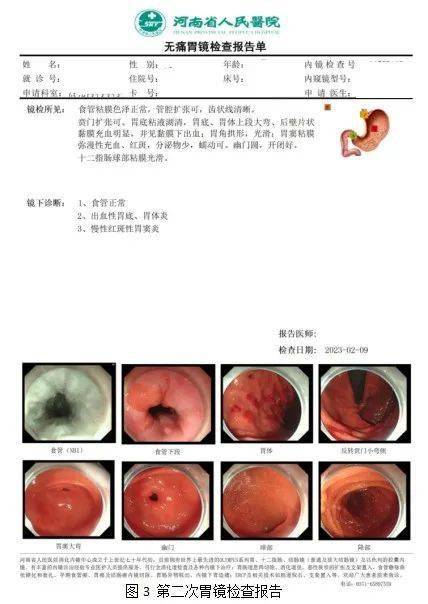 肠窦炎图片