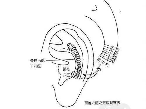 耳窝的位置图图片