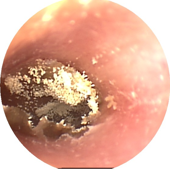 全国爱耳日科技助听共享美好生活