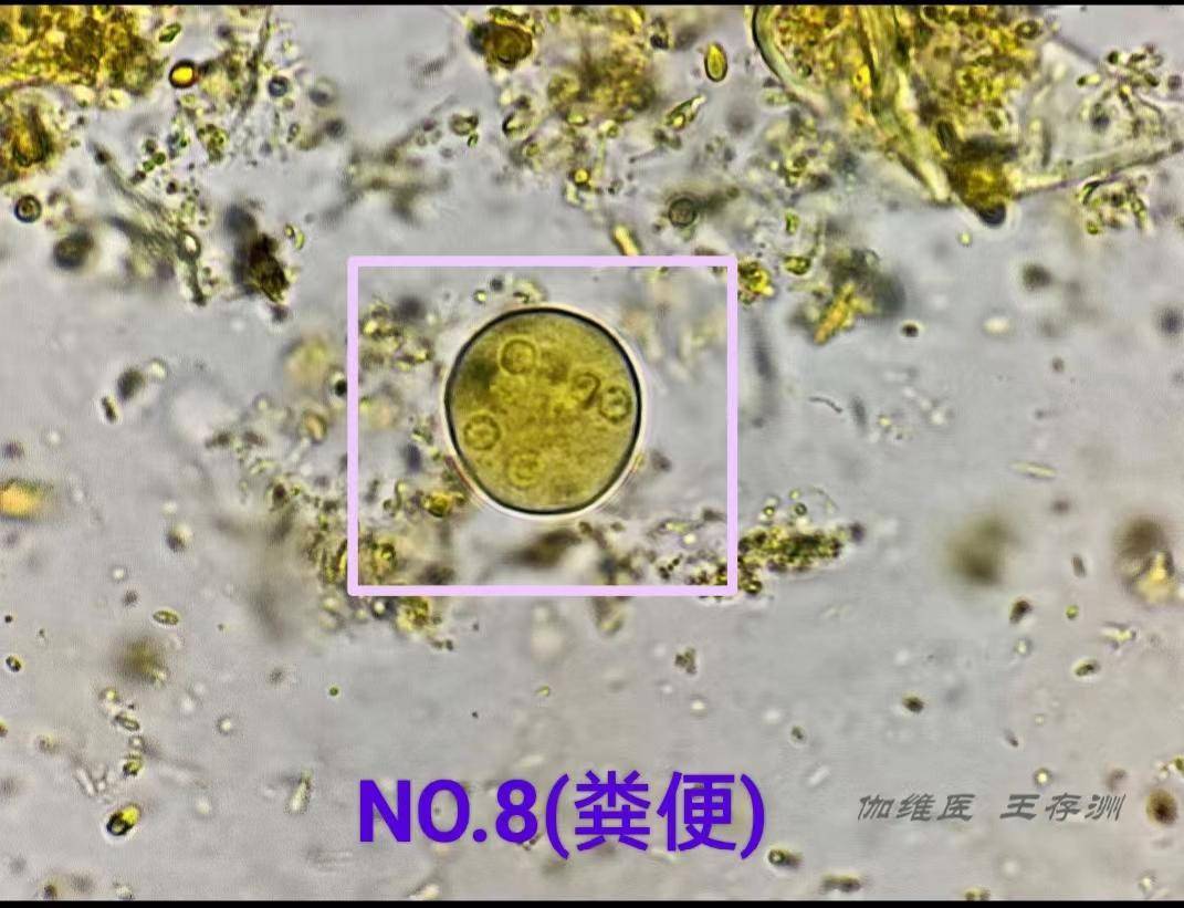 看圖識細胞(第126期)_顆粒_來源_檢驗