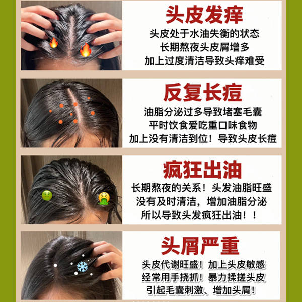 头皮屑毛囊炎等头皮问题产生的原因:头屑(头皮屑)和头皮红疹可能由多