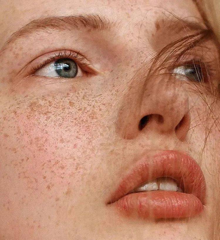 脸色黯沉发黄× 肤色不均匀×  毛孔粗大× 黑眼圈×  还有些斑*点痘*