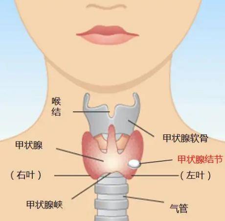 守护女性美丽和健康别忽视甲状腺