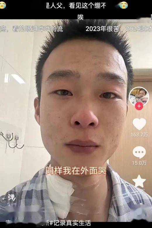 27岁单亲爸爸割肝救女女儿去世后一夜白头从此心肝宝贝都没有了