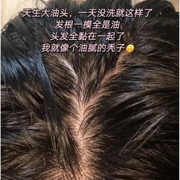什么品牌洗发露有二硫化硒