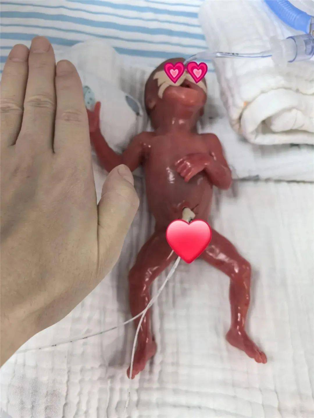 怀孕21周胎儿图图片
