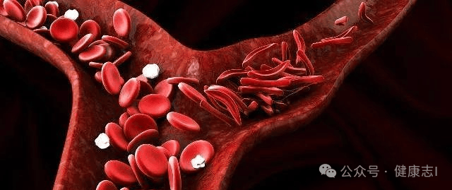 身体若发出这4大信号预示你可能"血稠如粥"了,该引起!