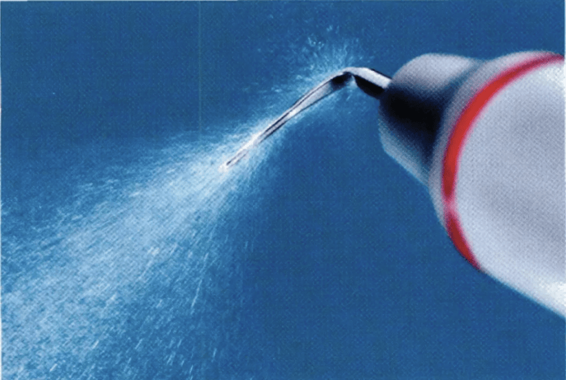 一种会让牙齿掉光的病,很多人年轻时不重视 | 每日健康_牙龈_牙周