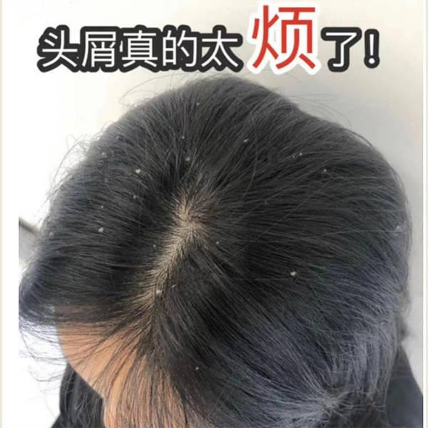 二硫化硒洗发水有哪些牌子国产好洗发水排行榜