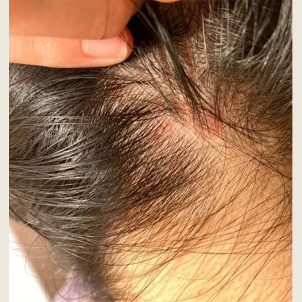 洗发水止痒成分是什么世界顶级洗发水排名榜