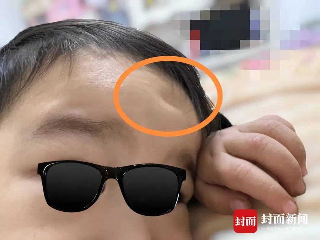 宜宾一幼童在早教课上摔伤致十级伤残