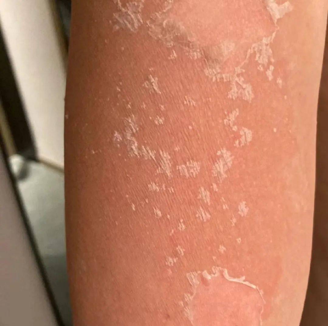 清爽到飞起!有了它,40℃的天气都不怕!_皮肤_夏天_版型