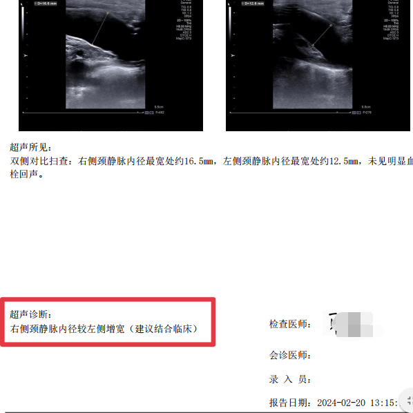 大隐静脉超声图片图片