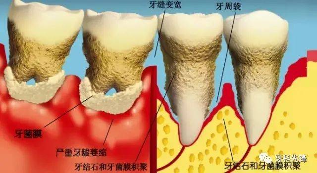 牙医给自然脱落的牙齿拍微距照片万万没想到