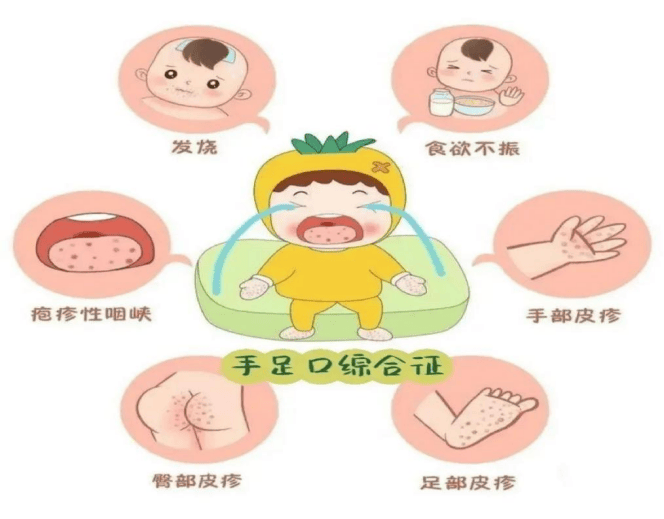 and prevention勤洗手,饭前,便后,加工食物前应按照7步洗手法正确洗手