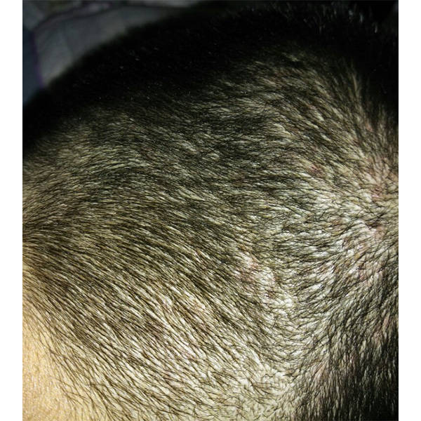 洗发水国货止痒介绍_头发_头皮屑_问题