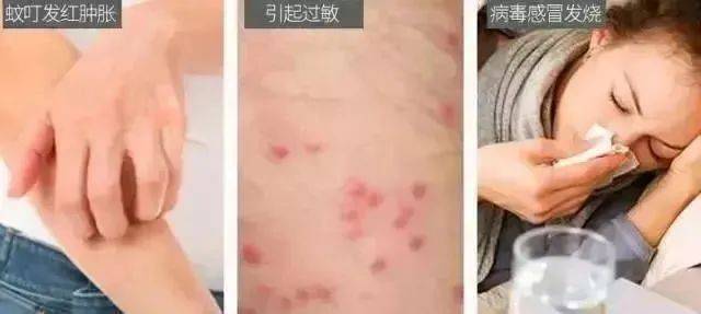 亲测有效的驱蚊绝招高效更安全