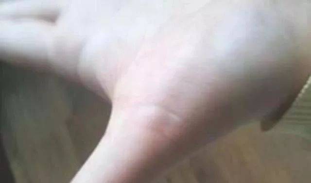 一旦发青,寒气或已深入_脾胃_肚脐_问题