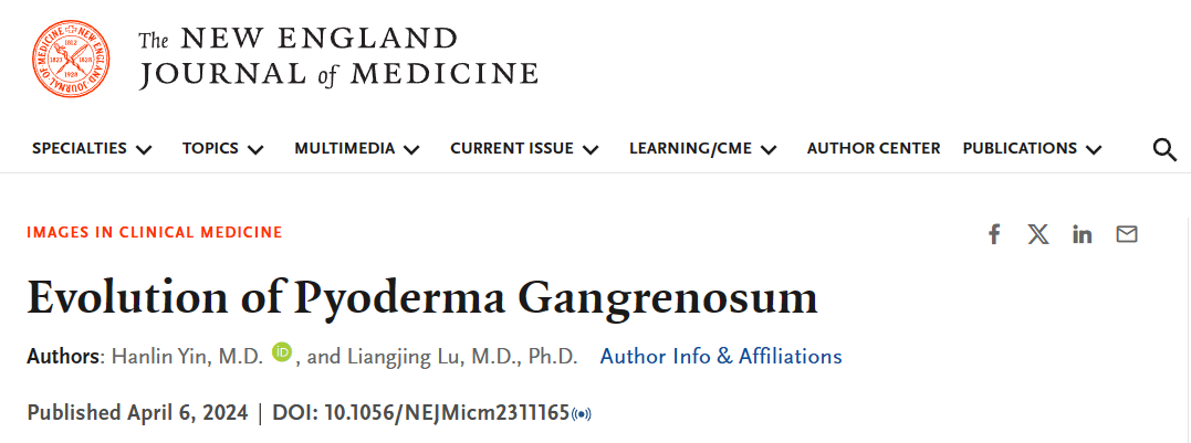 重磅风湿科吕良敬团队病例登上国际顶刊新英格兰医学杂志