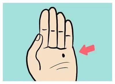 金小鸥讲健康 | 色素痣是怎么回事?都需要点了吗?听皮肤科专家怎么说!