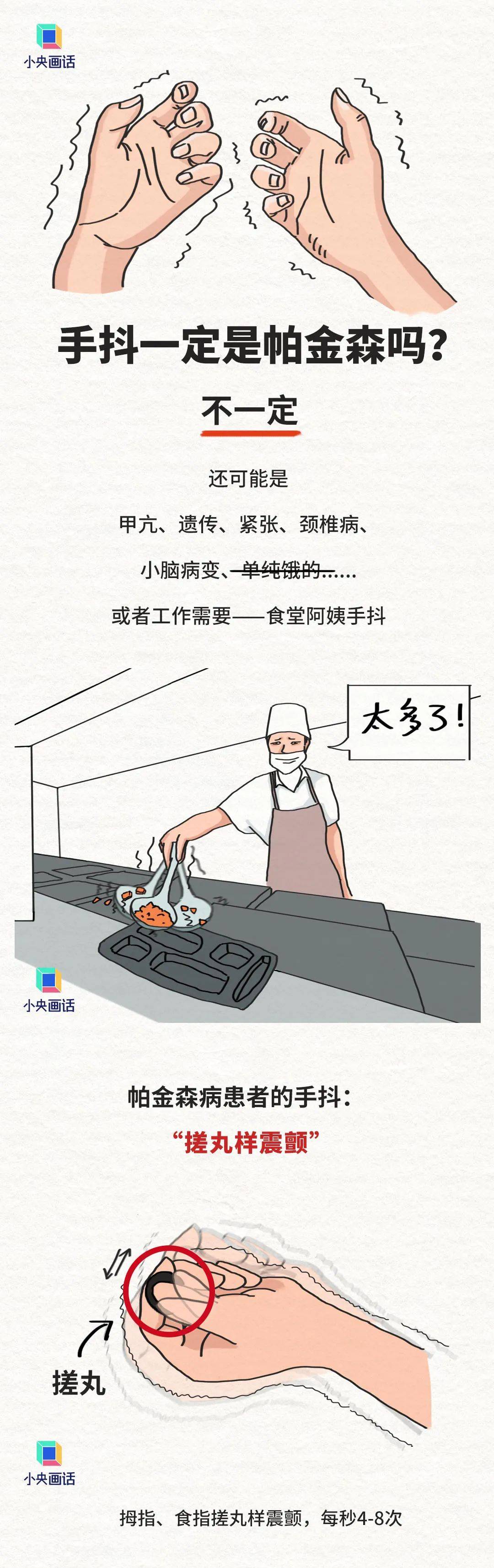 手抖就是帕金森？连年轻人也躲不过……