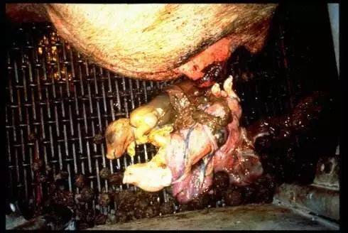 特别全,建议看一下_原因_胎儿_胎盘