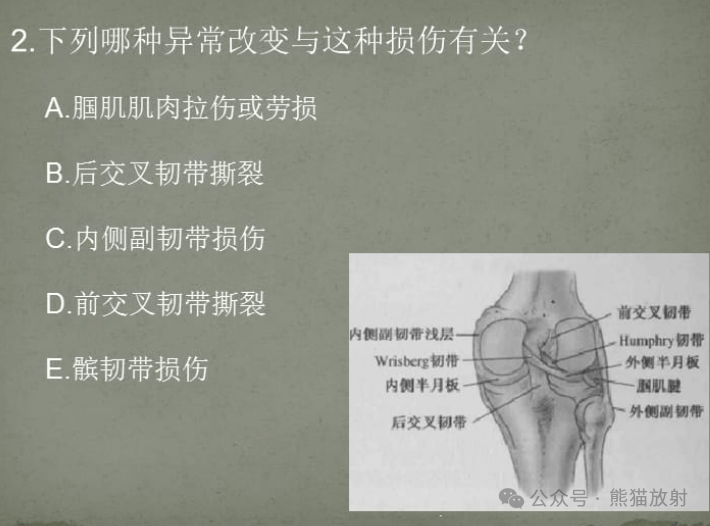 综述丨膝关节后内侧角的解剖,常见损伤及其mri表现