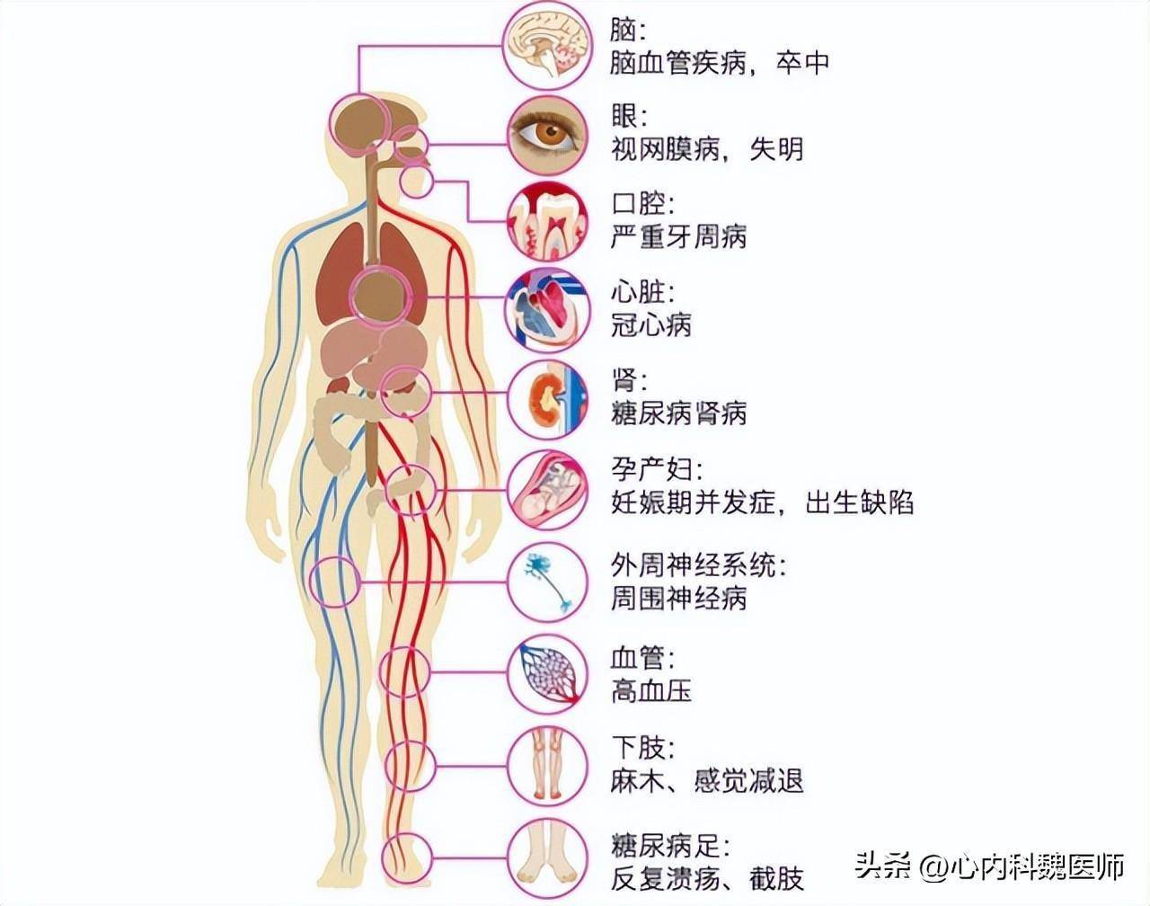 "甘油三酯大户"被揪出,提醒:55岁后,这3类食物尽早忌口