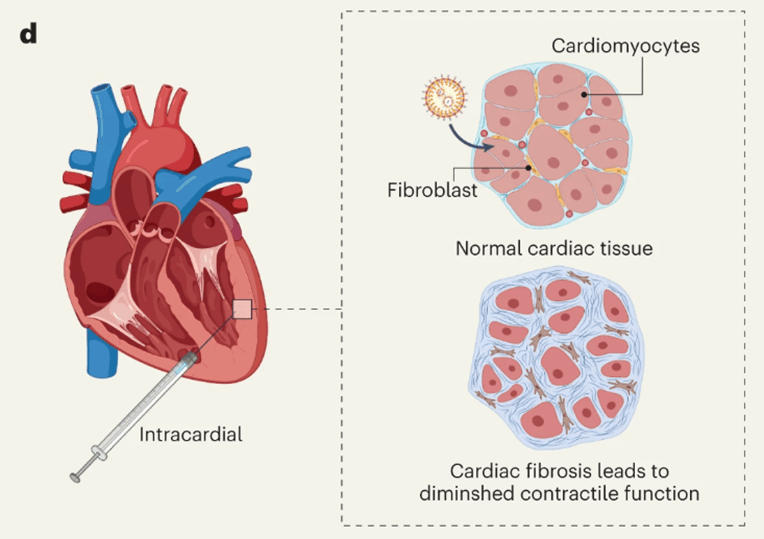 心肌细胞来修复受损心脏组织人们已经探索了各种核酸药物形式如rnai