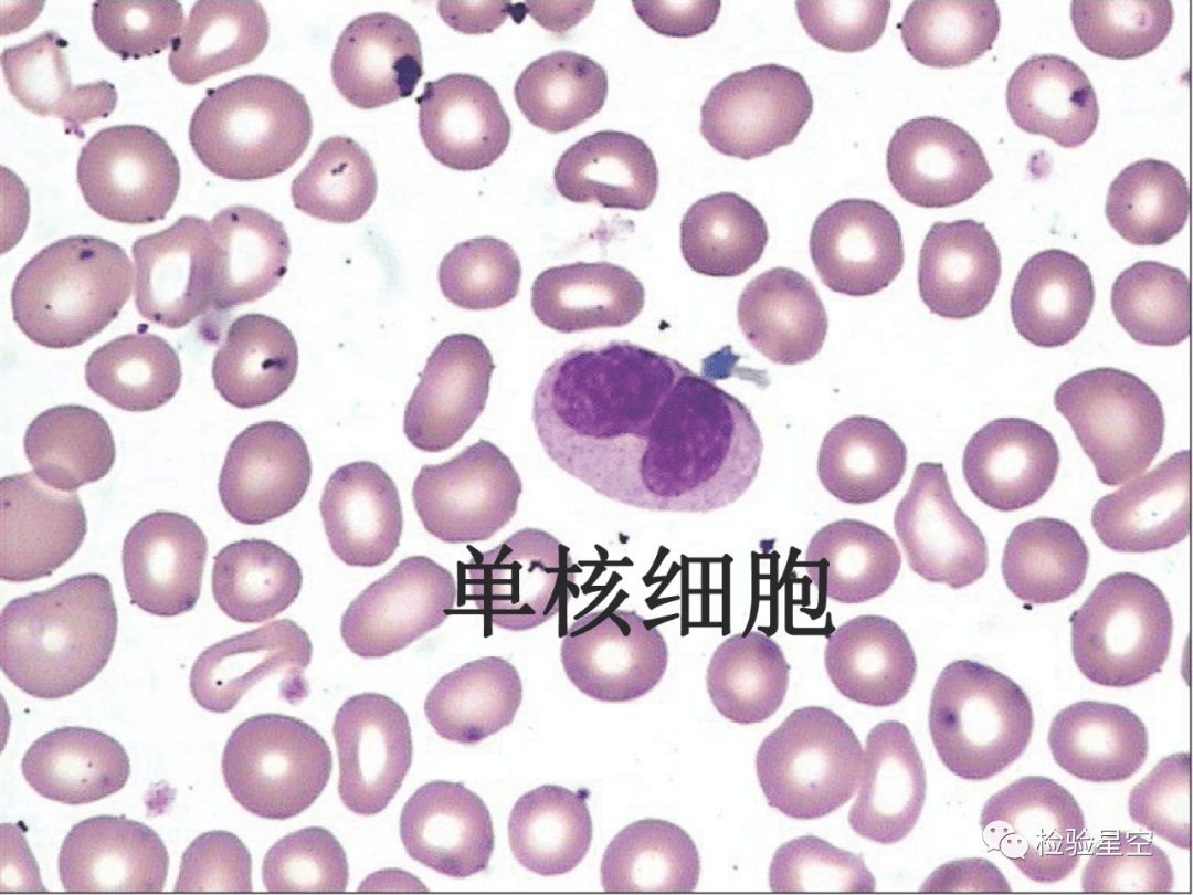 检验人爱的干货!血细胞典型形态学图谱(118张)