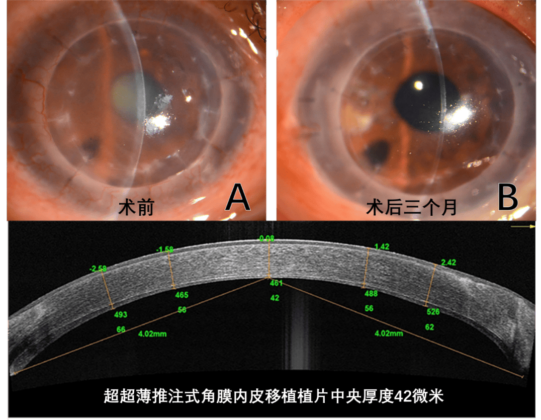 带您了解:造血系统恶性肿瘤--淋巴瘤