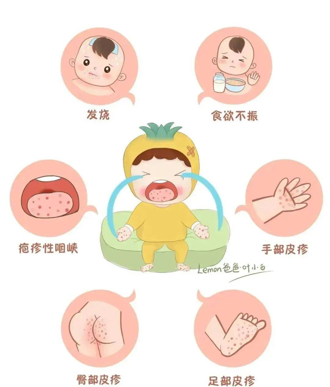 健康我先行——龙江实验幼儿园手足口病预防宣传