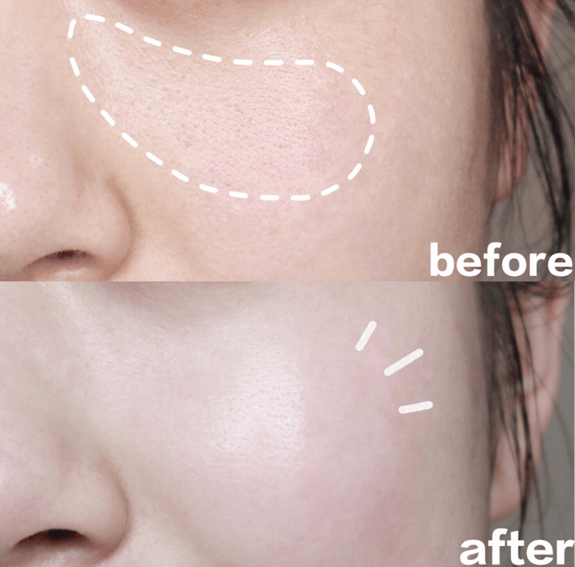 sk2小灯泡美白精华,小银瓶精华和小红瓶精华有哪些区别?