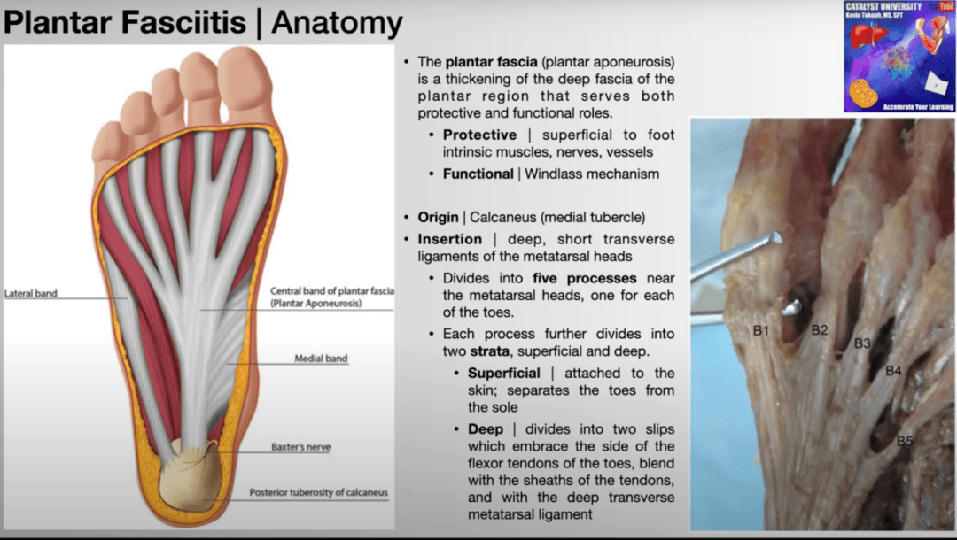 足底筋膜炎解剖图图片
