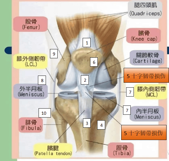 运动出现了膝盖疼痛