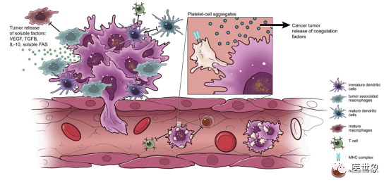 癌细胞是如何发生转移的?