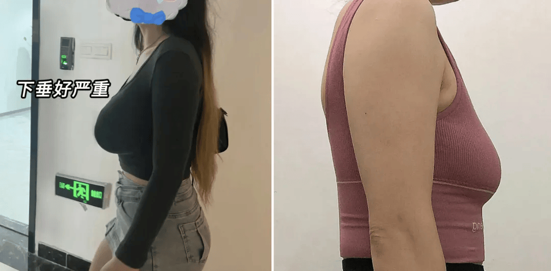 女生运动时最伤"胸部"的行为,被彻底忽略了….