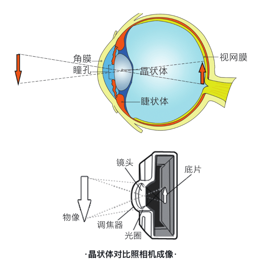 孩子近视了一定要戴眼镜吗?