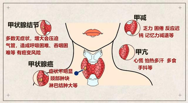 常见的有甲亢,甲减,甲状腺结节,亚甲炎,桥本甲状腺炎等.